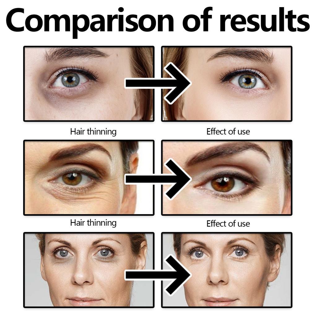 Eelhoe Eye Firming Cream Anti Aging Formula For Dark Circles And Wrinkles 30g