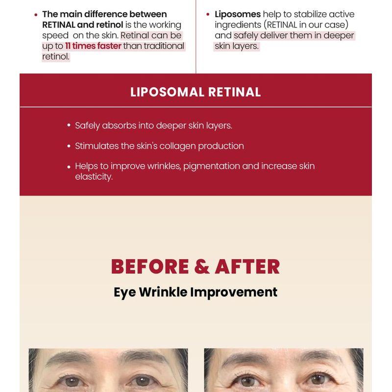 KSECRET SEOUL 1988 Augencreme : Retinal-Liposom 4% + Fermentiertes Bohnen-Bündel-Set