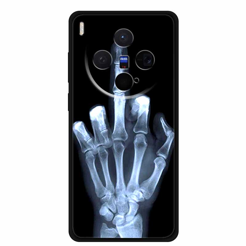 For Vivo X300 Case TPU Soft Cartoon Wolf Lion Silicone Protector Funda VIVO V2515 6.31  Coque Cases for Vivo X300 5G Phone Cover vivo X300