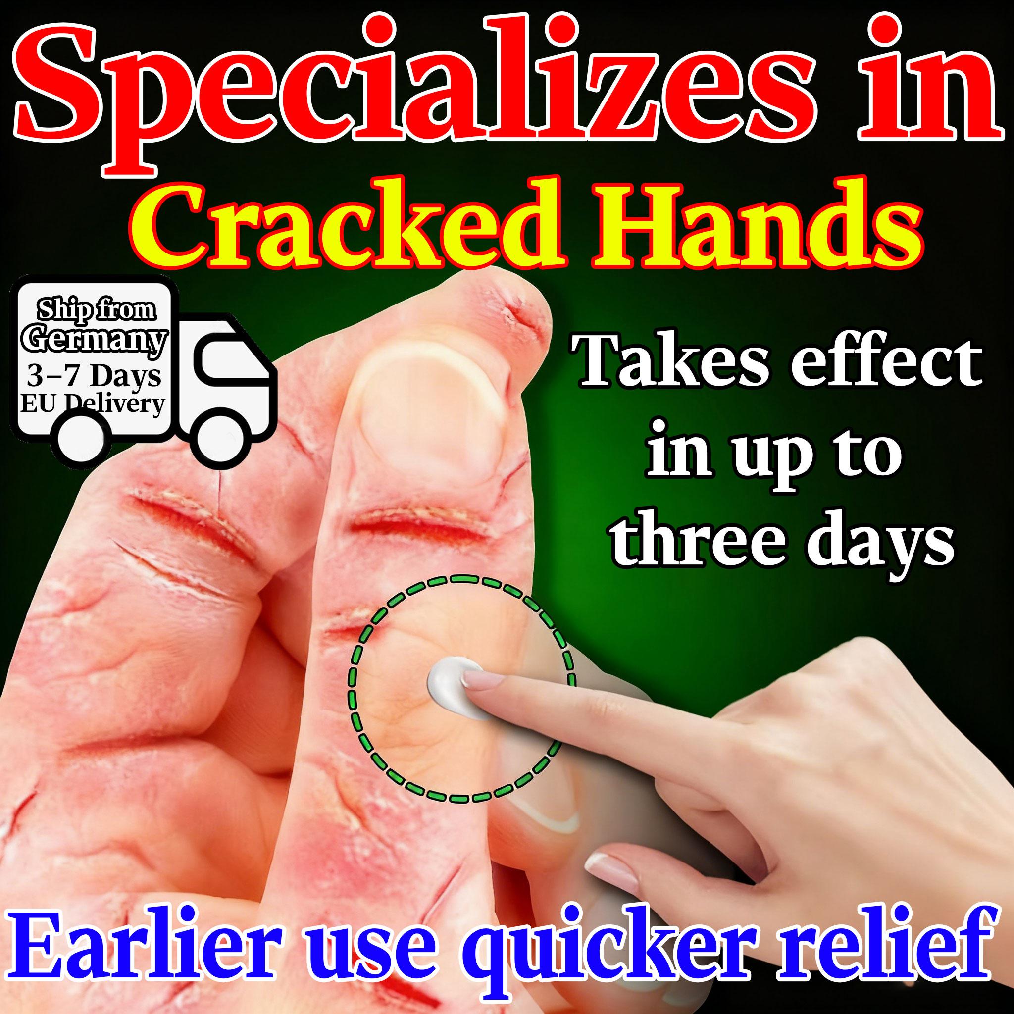 Natural Repair Ointment for Dry Cracked Hands & Feet - Deep Nourishing