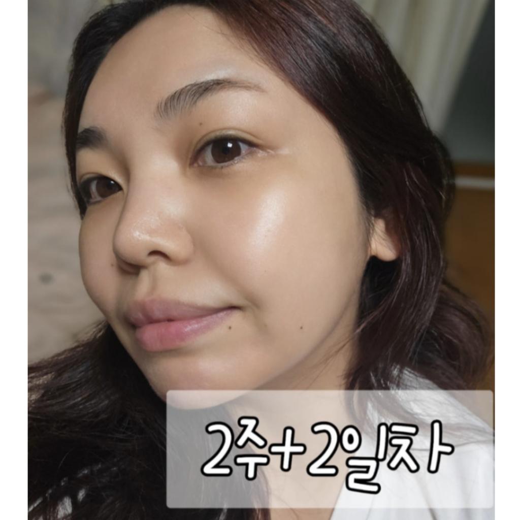 [ARNE] Xcelinu PDRN Skin Booster Ampoule 30ml