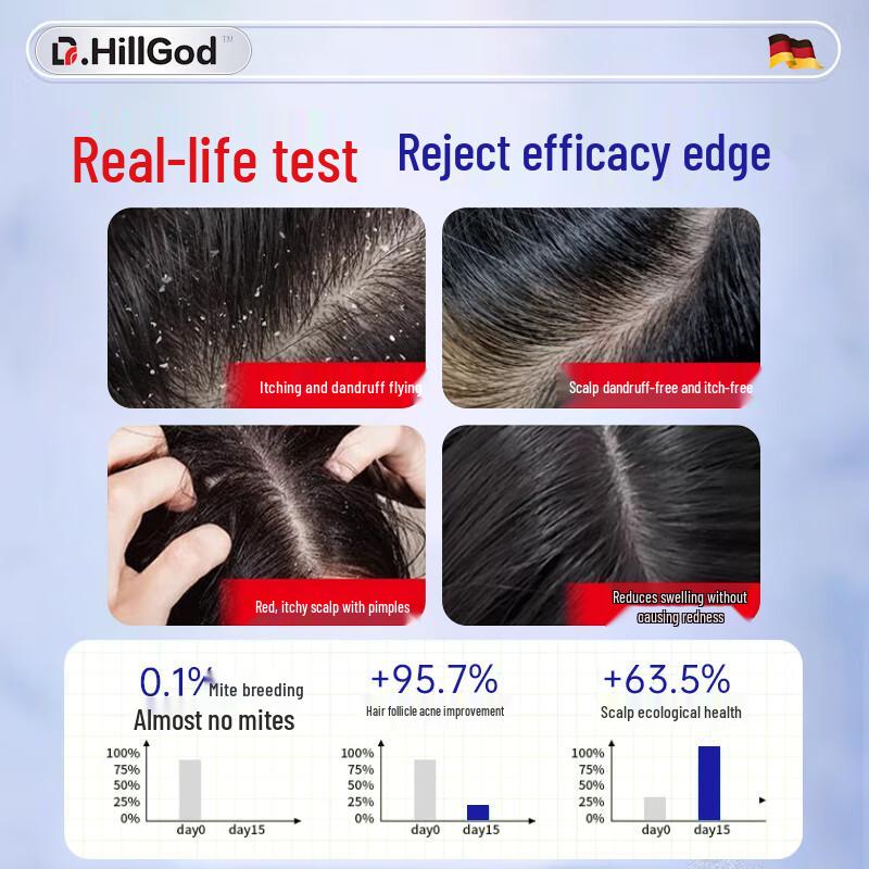 Szampon leczniczy Dr.HillGod z dziegciem węglowym na skórę głowy