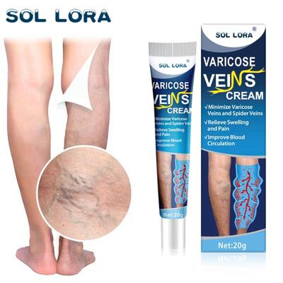 Varicose Ceam, 20g, Vasculitis, Phlebitis, Vascular Swelling, Best Teatment, Ointment, Skin Care Lotion