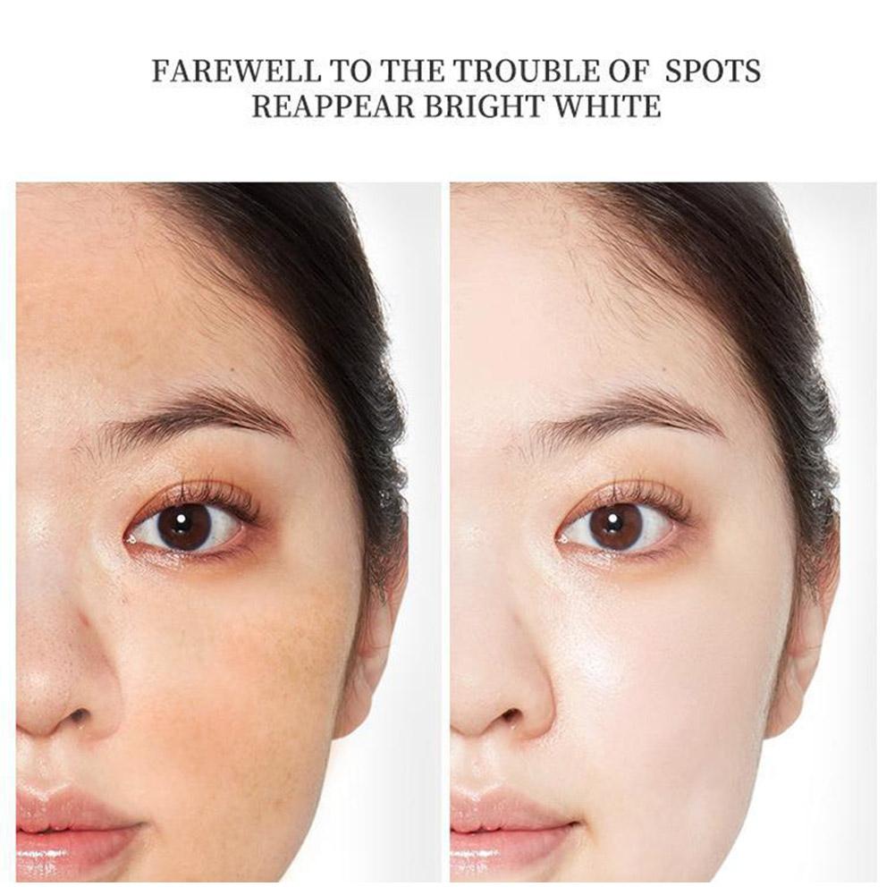 New Mild Cleansing Foam Face Cleanser Moisturizing Acne Whitening Skin Spot Removing Oil Care F X1B5