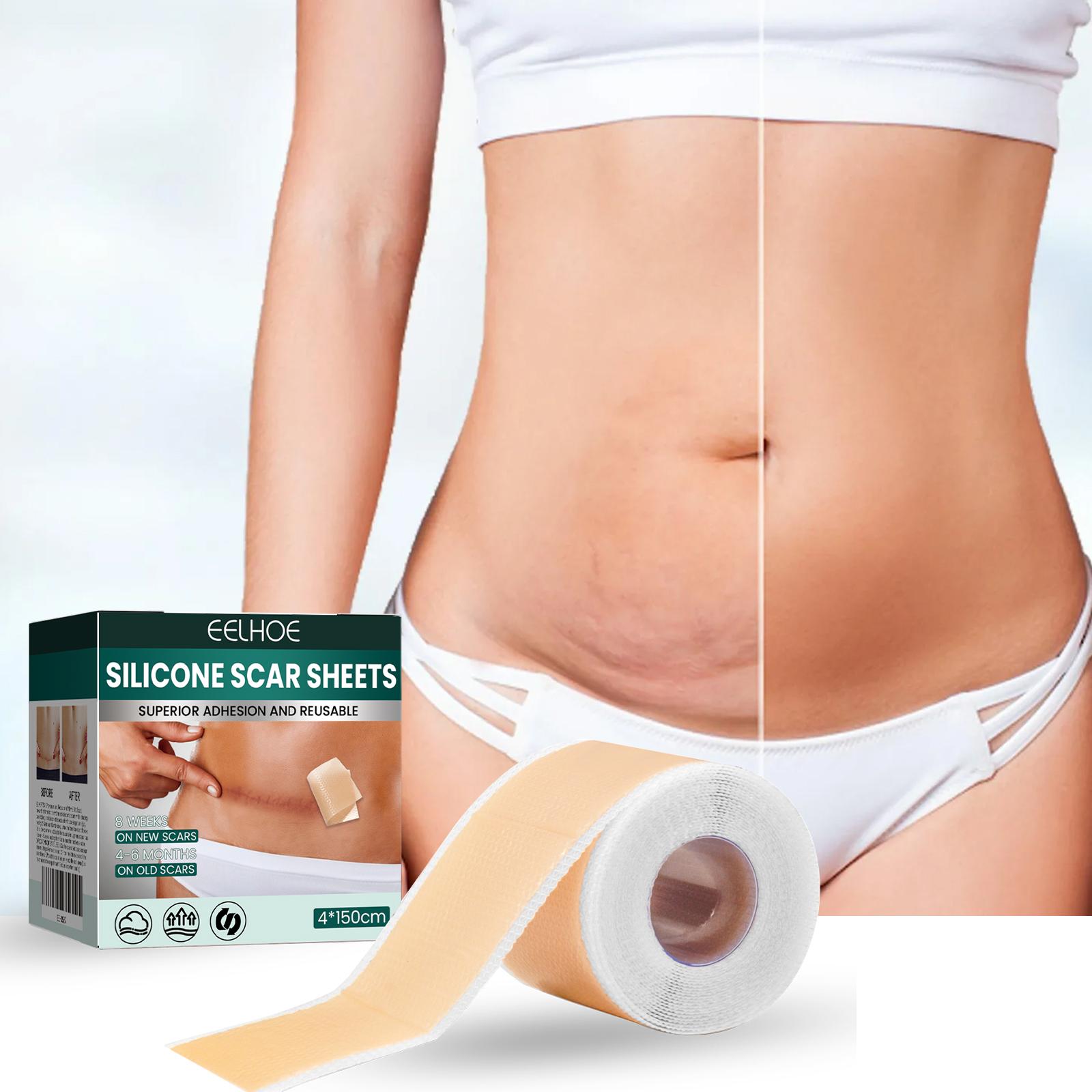 EELHOE Silicone Skin Care Patch Gentle Smooth  Body Skin Daily Comfort Lightweight Care Patch 1pc