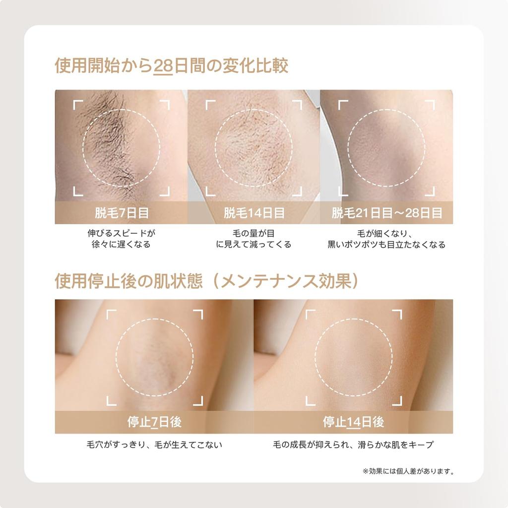 YETE Hair Removal Sapphire Home Light Hair Removal Device for Flash Painless Hair PSE Results Device, Cooling, VIO, Unisex, Type, Removal, Certified,