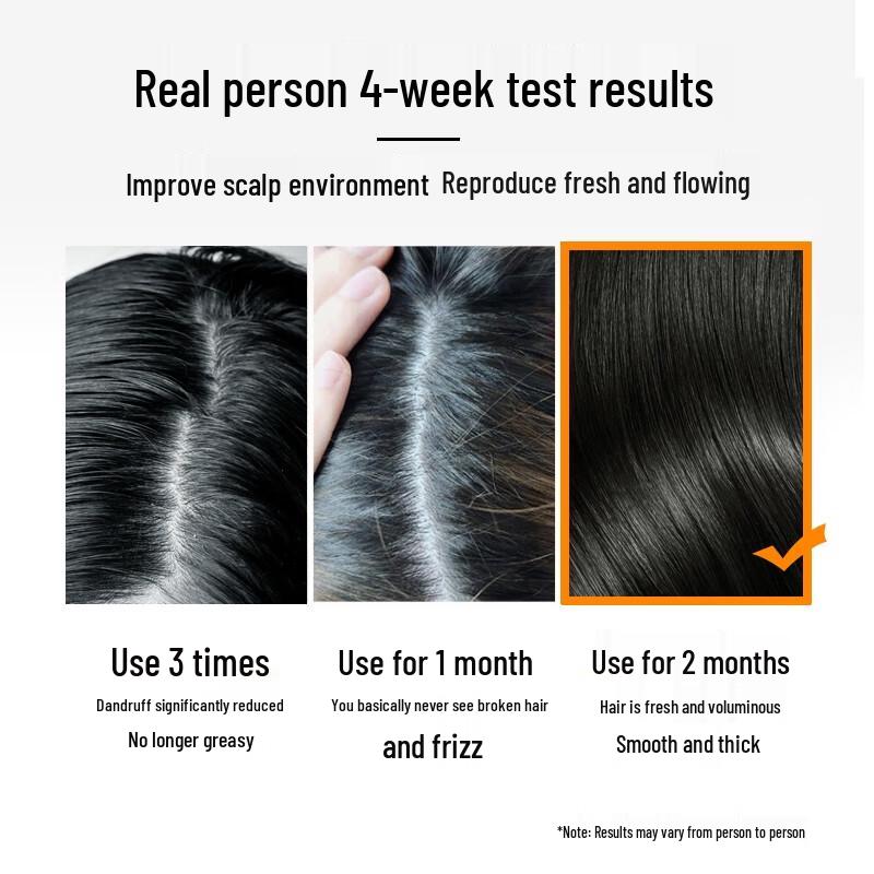 LK Ginger Extract Anti-Dandruff & Strengthening Shampoo