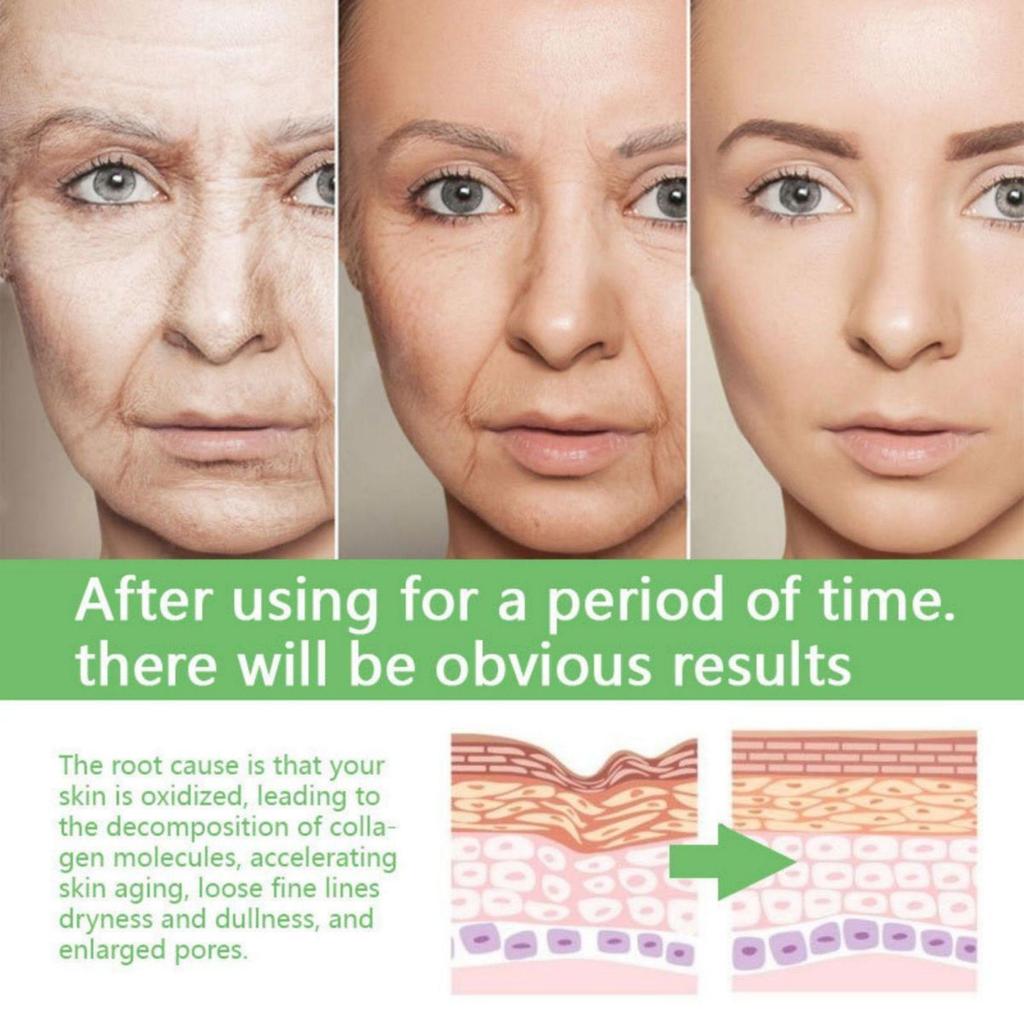 TRSTAY Vitamin C For Face Cream Pigments Dark Spots Removal Whitening Facial Cream Lightening Skin Care Products Beauty Health