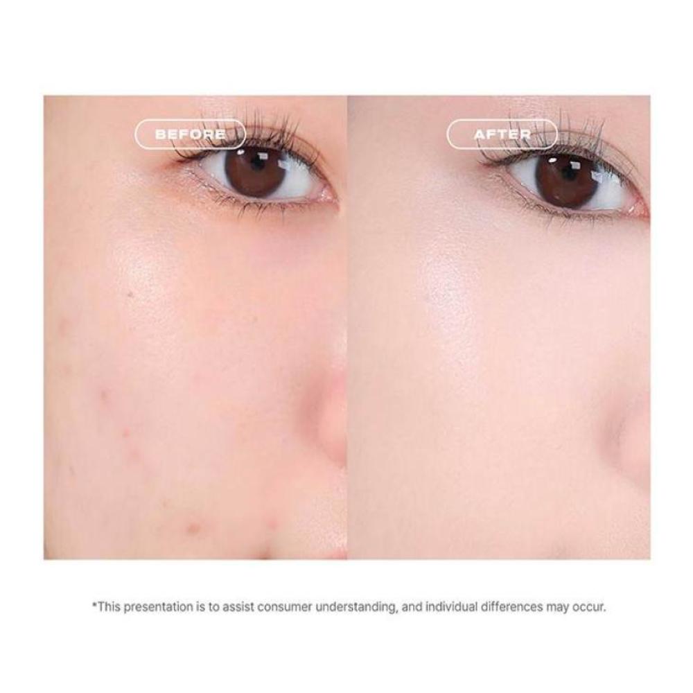 ABOUT_TONE Skin Layer Cover Fit Concealer 5.6g