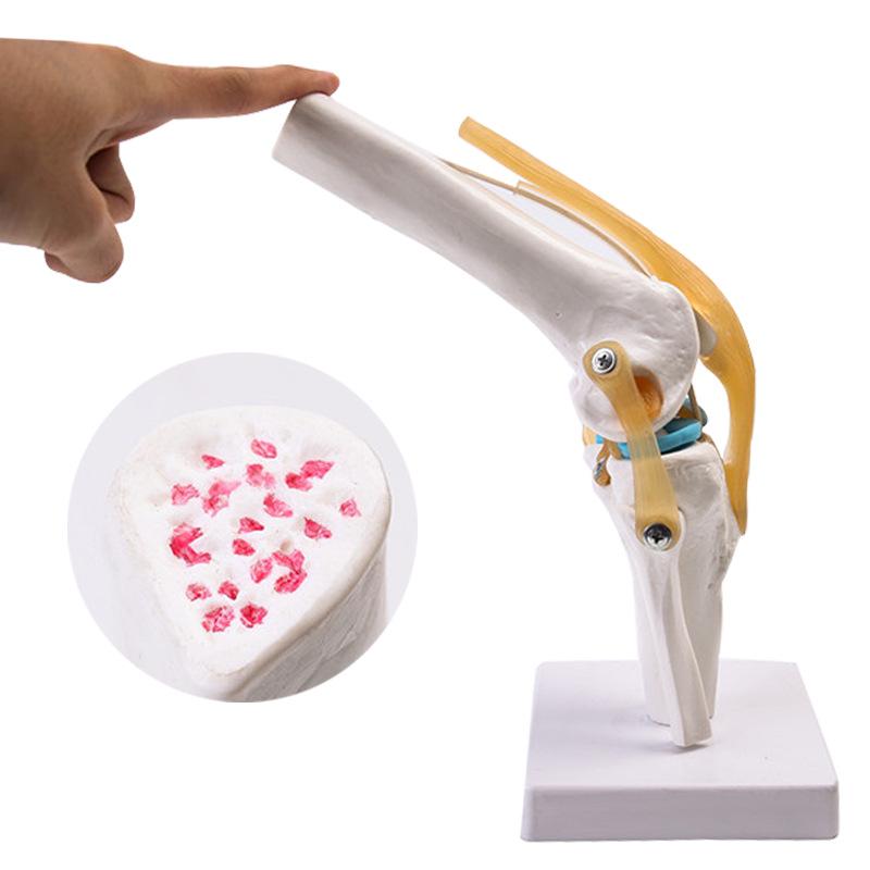 Human Knee Joint Model for Orthopedic Teaching and Display