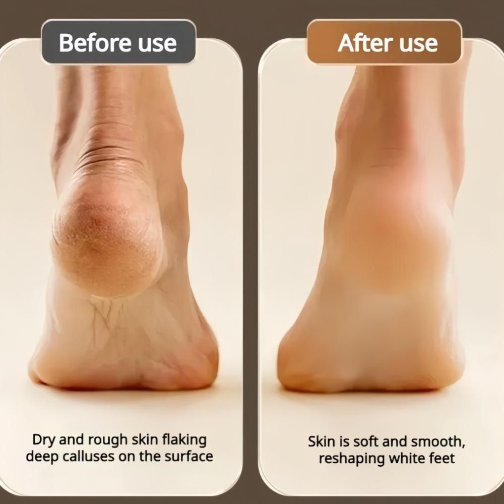 Electric ABS Foot Grinder Dead Skin Remover Calluses Feet Scrubber Electric for Rechargeable Foot Calluses Feet Dead Cracked