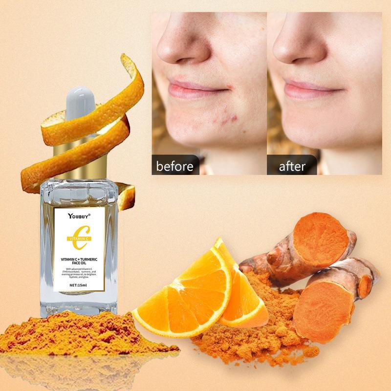 VC Turmeric Essence Brightens Facial Complexion, Vitamin C Essence Oil moisturizes and Reduces Fine lines