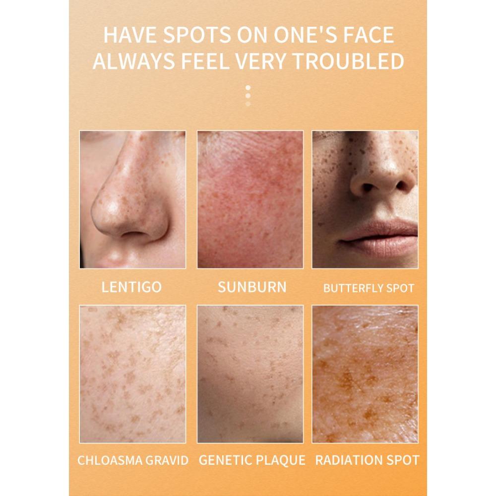 Gurkemeieessens lysner hudtonen og reduserer melasma
