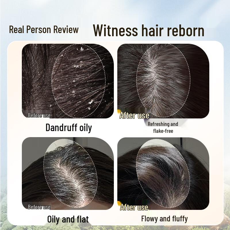 Bawang Ginger & He Shou Wu Anti-Dandruff Oil Control Shampoo