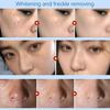 Tattoo Concealer Freckle Cream Brighten Skin Tone Cover Tattoo Scar Birthmarks Waterproof Concealer