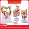 Large Intestine and Rectal Hemorrhoids Anatomy Model