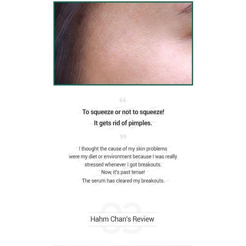 SOME BY MI AHA, BHA, PHA 30 Days Miracle Serum 50ml