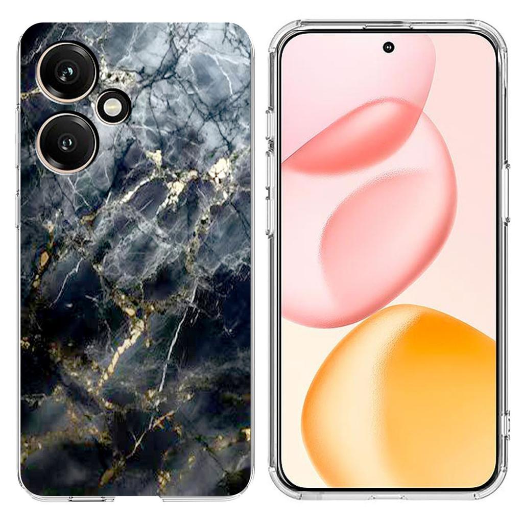 For Honor 400 5G (Global) Case Marble Pattern Printing Soft TPU Phone Cover