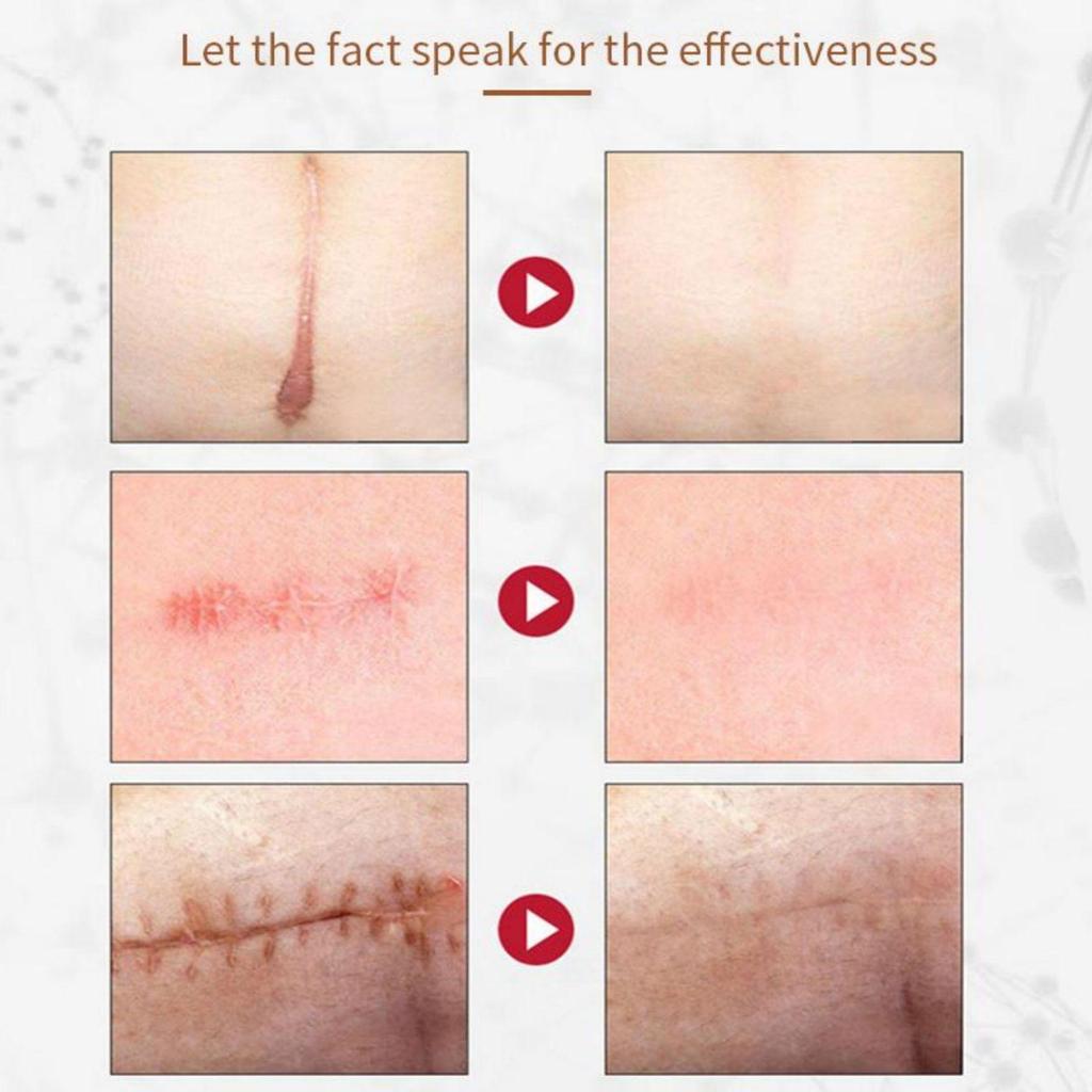 Scar removing essence repairing skin whitening brightening essential oil moisturizing and hydrating fluid