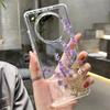 Couple Rose Flower Phone Case For Honor 400 Lite 200 Pro 90 Smart 70 X7 Oil Painting Clear Transparent Soft Cover Honor 400Pro