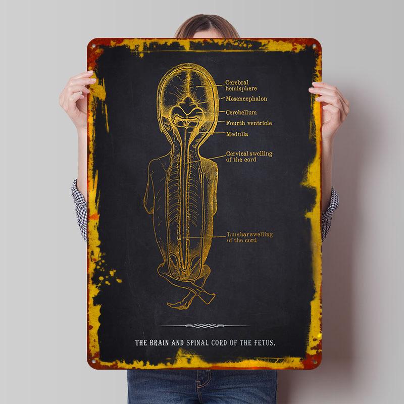 Fetus Brain Spinal Cord Tinplate Poster Customized Wall Art Vintage Retro Metal Signs for Decoration Bedroom Decorations Decor