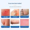Herbal Pressure Sore Cream: Soothes Discomfort, Reduces Swelling, Gentle Texture for Deep Absorption