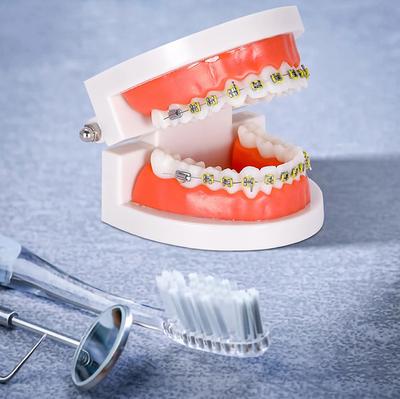 Modelo de dentes ortodônticos dentários de 1 peça com aparelho de metal, equipamento de ensino escolar