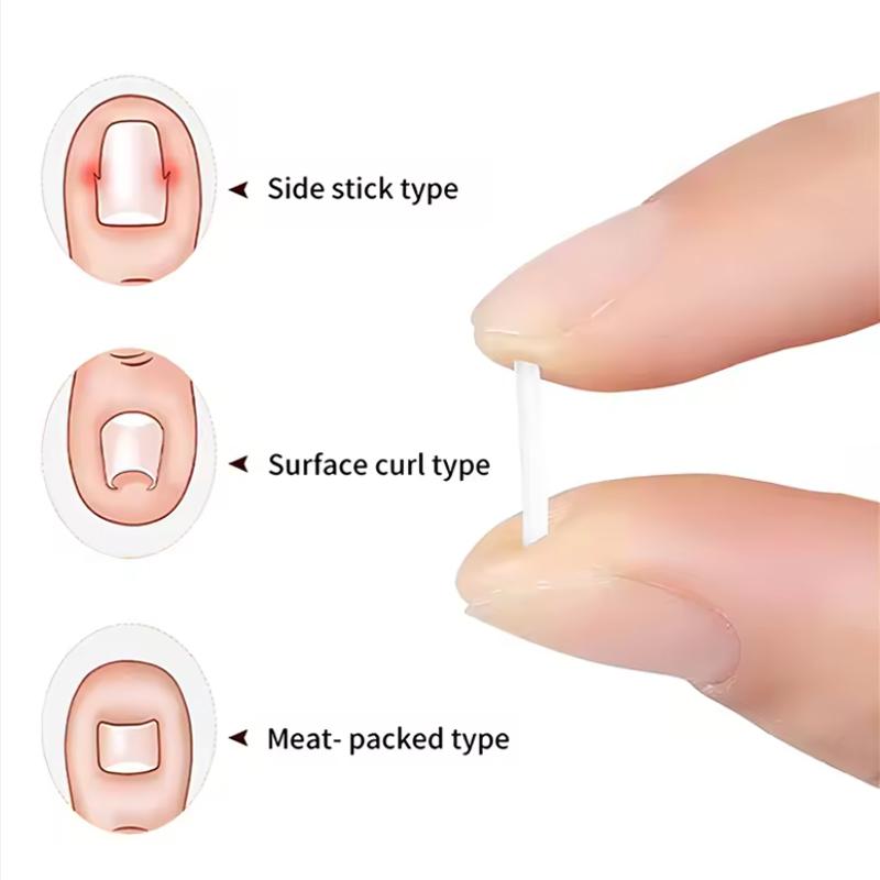 Ingrown Toenail Correction Tool Elastic Patch Nail Filling Pad Toe Straightening Clip Brace Ingrown Nails Pedicure Treatment