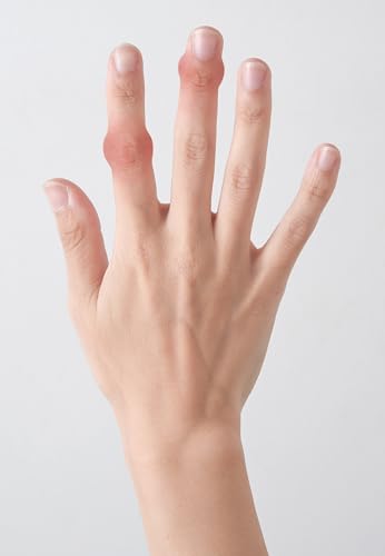 Two Black Finger Joint Supporters, Designed by an Orthopedic Clinician