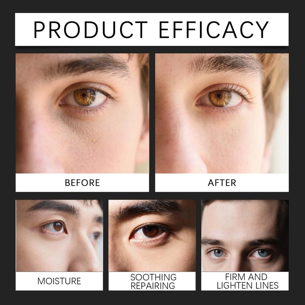 East Moon Niacinamide Men Eye Firming Cream Fade Fine Lines Remove Dark Circles Moisturizing Dryness Eye Nourish Creams Sticks