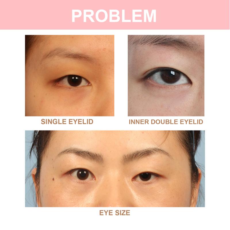 Double Eyelid Styling Cream Natural Invisible Eye Lift Eyelid Adhesive Cream Quick-Drying Long Lasting Eyelid Glue With Y Stick