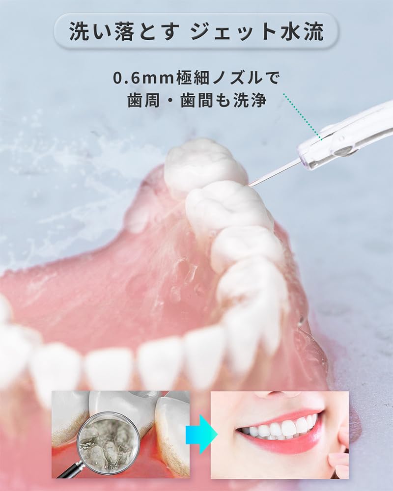Infly P11S Oral Irrigator Jet Washer Water Flosser with Large Capacity 300ml Portable 150ml Two 4 Nozzle Settings Pocket USB IPX7 for Travel and Home