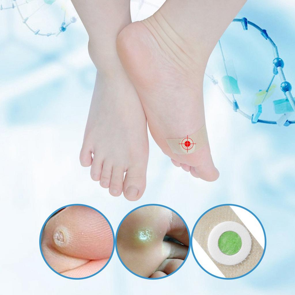 Corns Patch Reduces Corns, Calluses, Spines, Plantar s, Corns Ointment, Corns Ointment, Toe Corns Remover, Foot Calluses Health Patch.
