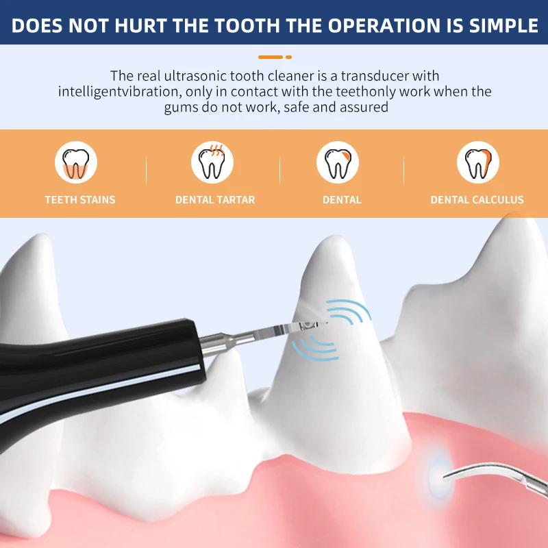 Ultraschall-Zahnreiniger für Hunde, tragbar, professionelle Tierpflege, Zahnreiniger, Leistung 200 W, fünf Gänge, Reinigungsprodukte für Haustiere