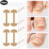 20-100pcs Adhesive Toenail Patch Ingrown Toe Nail Correction Sticker Foot Corrector Pedicure Health Care Tools Toe Treatment Pad