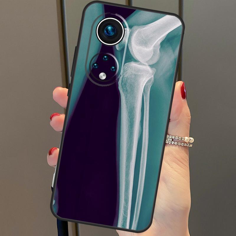 

Рентгеновская анатомия человека для Huawei P20 P30 P40 Lite Pro P Smart 2019 Nova 9 5T чехол для телефона Honor 50 8X 9X 10i Honor 50 Lite