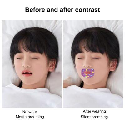 1 Box Breathable Universal Practical Comfortable Mouth Correction Stickers Good Slumber Patch Product Mouth Orthosis Tape