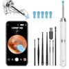 2025 Latest Model  Ear Wax Removal, Ear Cleaner with Camera and Light, Ear Wax