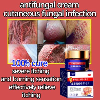 Male Private Parts Itching Antiitching Ointment Fungal Infection Private Parts Large Erythema Acne Itching Intolerable