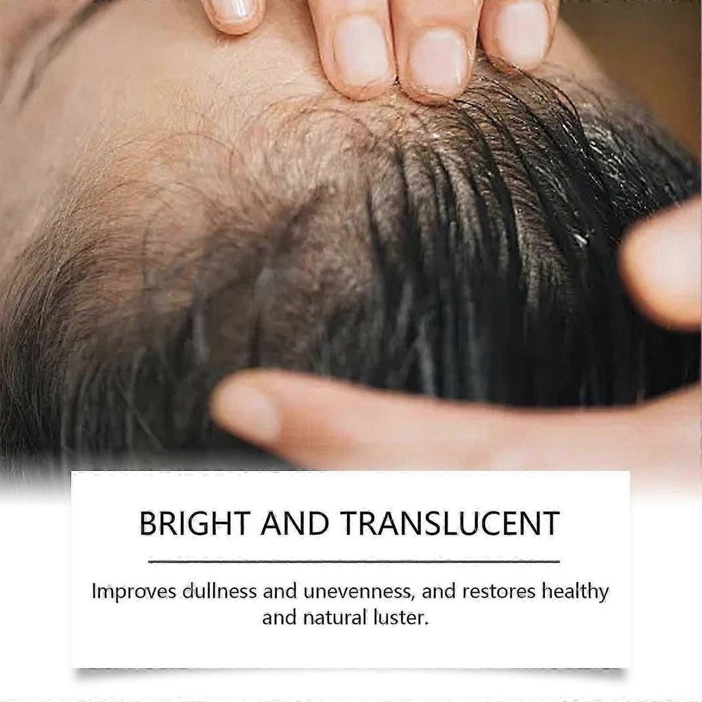 Ouhoe Facial Care Essential Oil Gently Tightens, Brightens And Penetrates The Facial Skin, Moisturizes And Nourishes, And Reduces Fine Lines