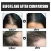 EELHOE Dense Hair Fiber Powder Hair Increase, Hair Volume Fiber Thickness, Hair Powder and Plant Fiber Powder