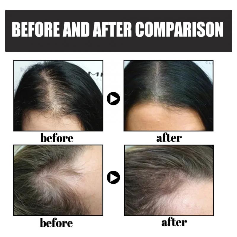 EELHOE Dense Hair Fiber Powder Hair Increase, Hair Volume Fiber Thickness, Hair Powder and Plant Fiber Powder