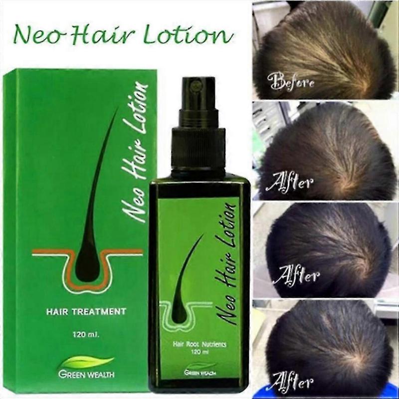 120ml Hair Lotion Green Wealth Growth Root Hair Loss Sideburns Treatment