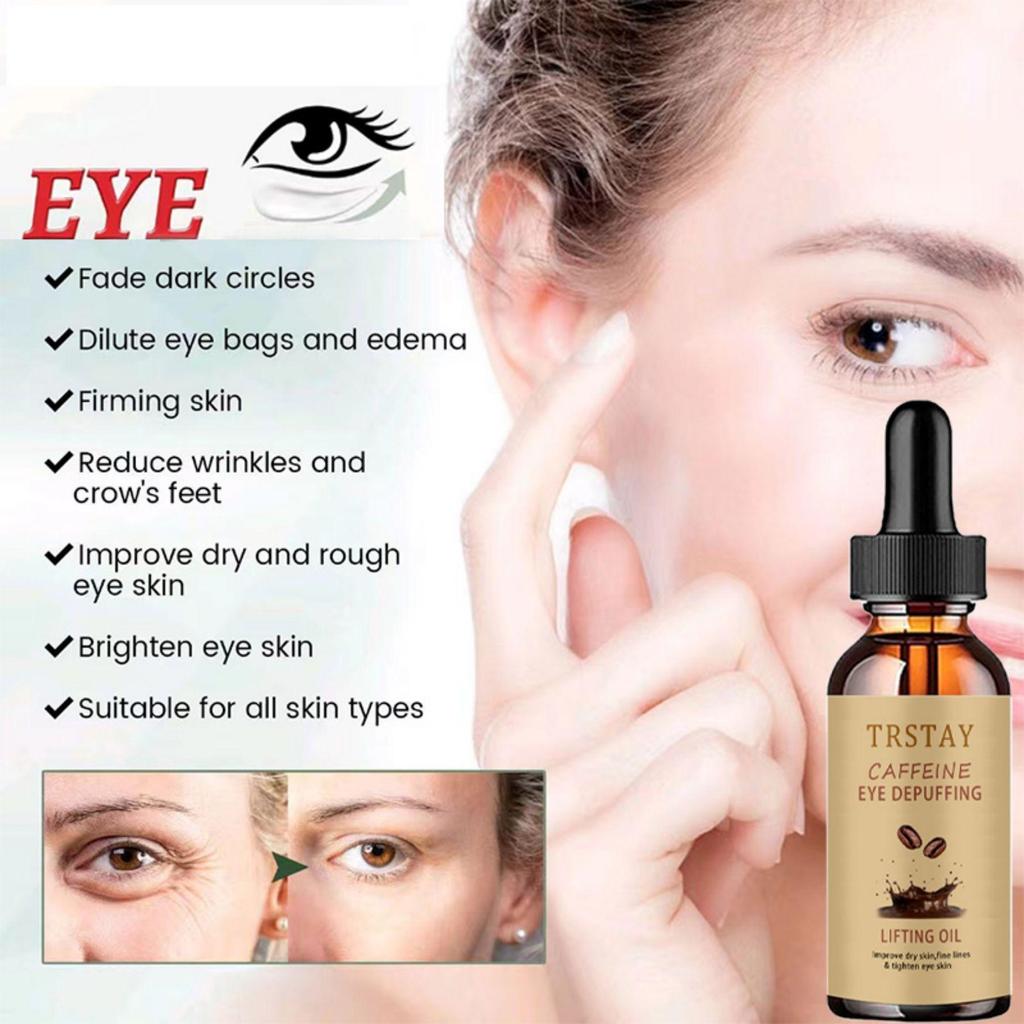 Aufhellende Creme zum Entfernen dunkler Flecken, Gesichtscreme gegen Sommersprossen, Creme zum Entfernen von Melasma und dunklen Flecken, aufhellende Creme zum Entferner