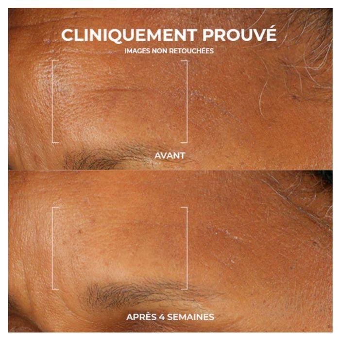 Soin Anti-âge - RoC - Retinol Correxion - Hydratant SPF30 - 30 Ml - Hypoallergénique
