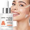 Peeling Serum-Deep Moisturing The Skin-Gentlely Refines Pores Skin Texture-Controls Excess Sebum-uitable For All Skin Types, 30ml