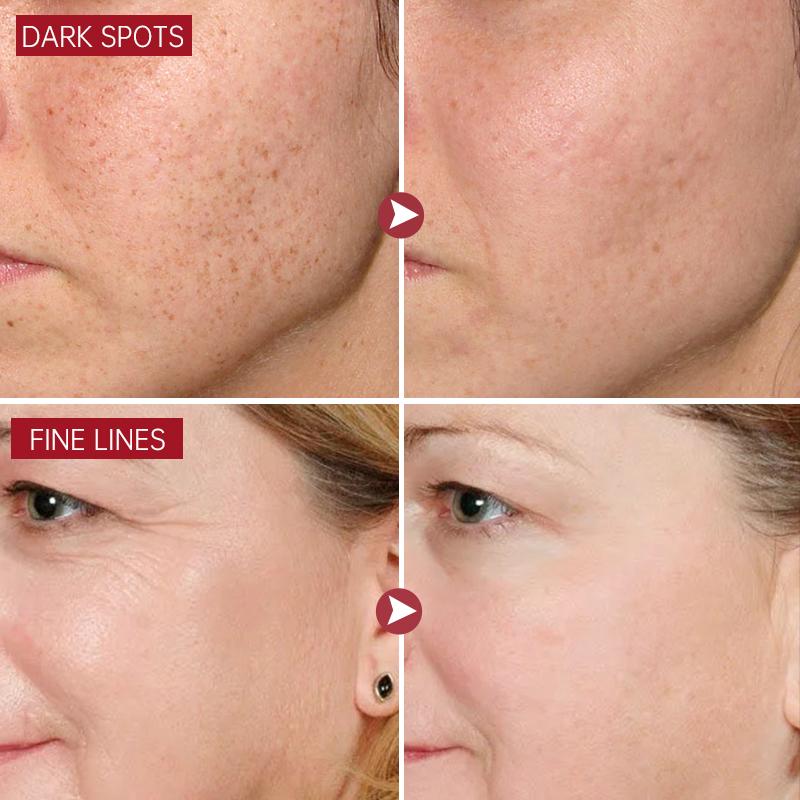 Whitening Face Cream Skin Care Emulsifier Nicotinamide Peptide Anti-aging Facial Wrinkles Face Cream Black Spot Removal Beauty and Health