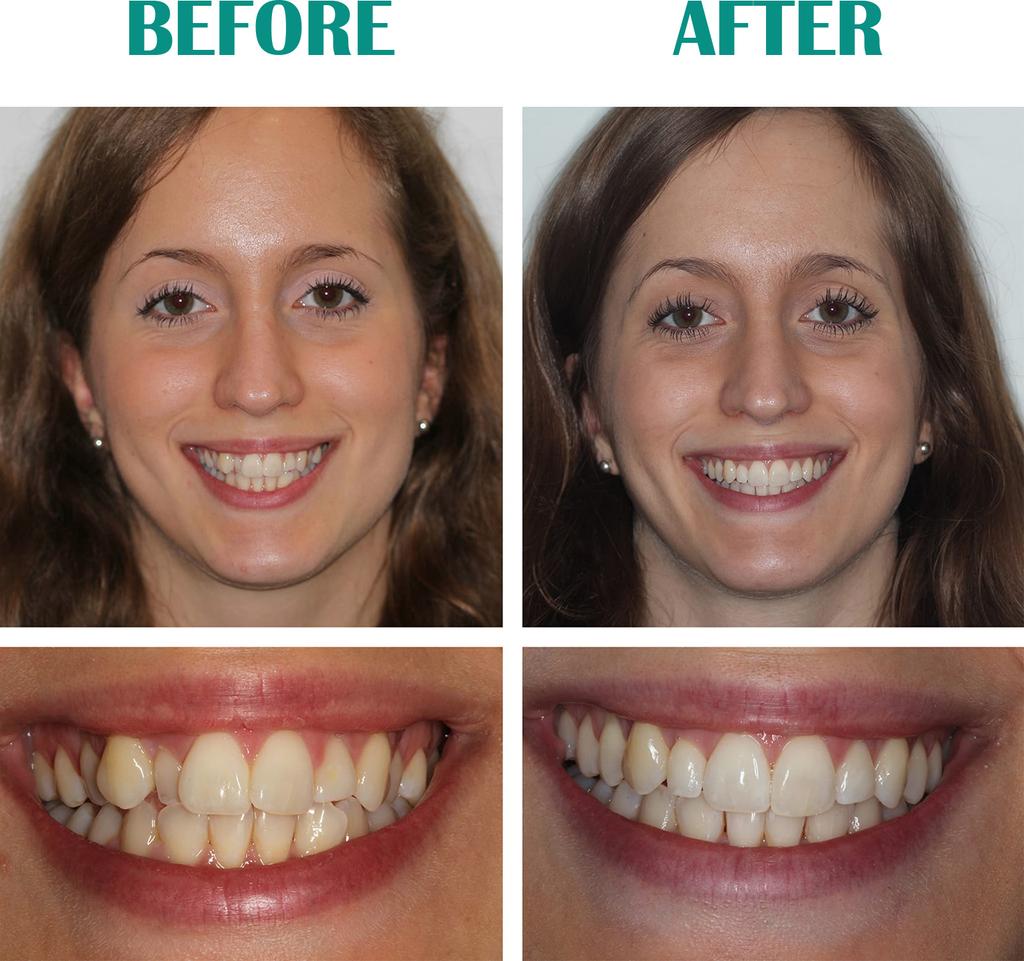 EELHOE Oczyszczanie zębów pianka wybielająca dokładne czyszczenie pasta do zębów piankowa pasta do zębów usuwa plamy świeży oddech narzędzia do pielęgnacji zębów 30ml