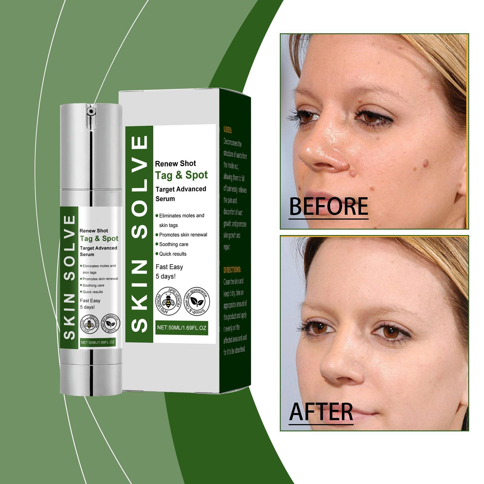 

Skin Concealer And Flat s And Provides Care For Facial And Eye s