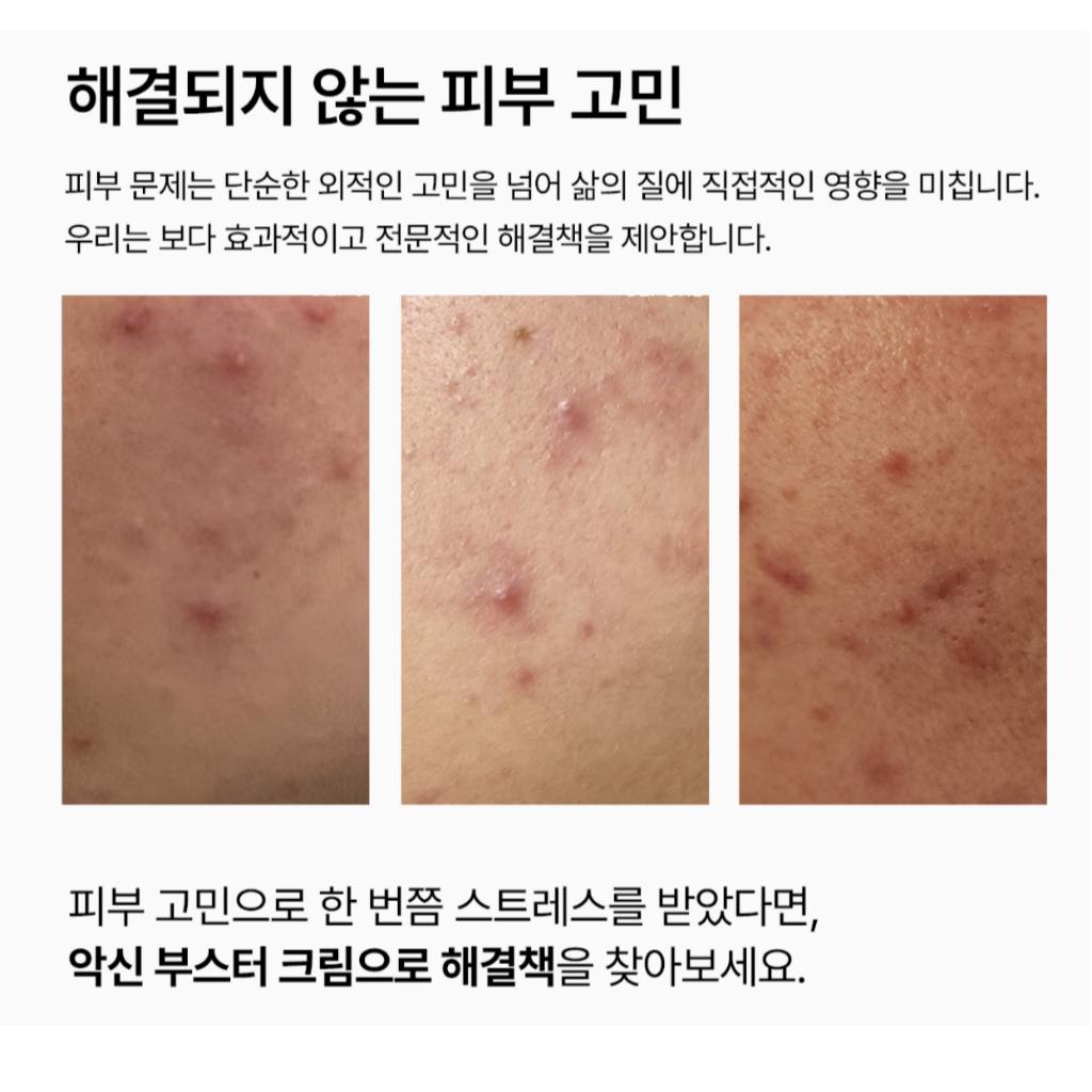 [Vemontes] Cremă Booster AXCNE 25ml